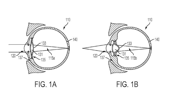 La lentille intelligente brevetée de Google va trouver sa place dans votre globe oculaire