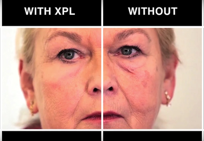 Un chercheur du MIT créé une peau artificielle qui vous fera paraître 10 ans plus jeune 49 mit nouvelle peau xpl 1 1