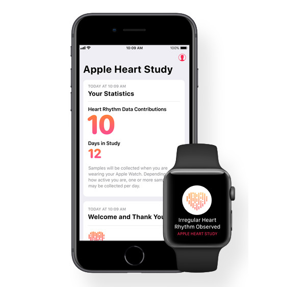 Apple développe une Apple Watch avec un moniteur cardiaque (ECG) intégré 50 Apple Watch Wearable