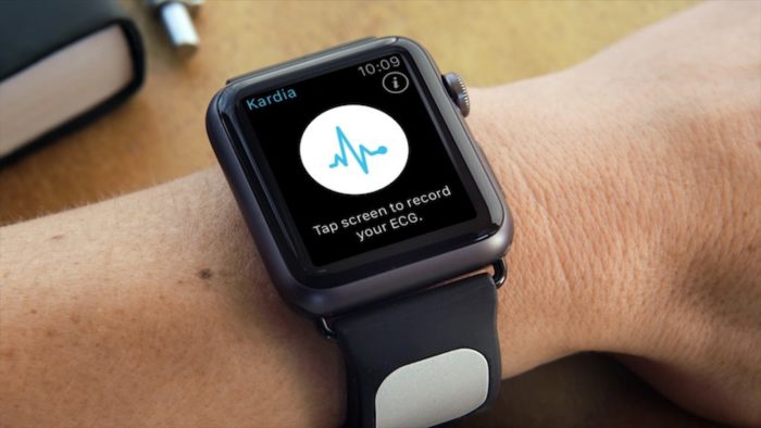 Apple développe une Apple Watch avec un moniteur cardiaque (ECG) intégré