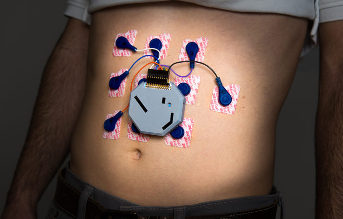 Cet appareil connecté surveille l’activité électrique dans votre estomac