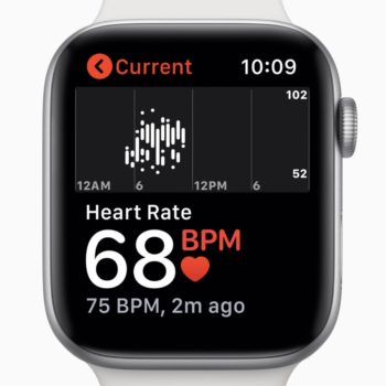 apple pourrait lancer fonction ecg apple watch 4 europe 1