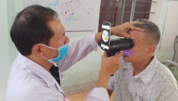 eyelike KV e1617901641467