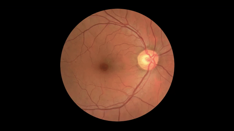 google health arda anim