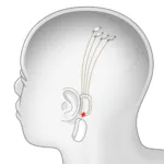 Neuralink graphic e1594299472339