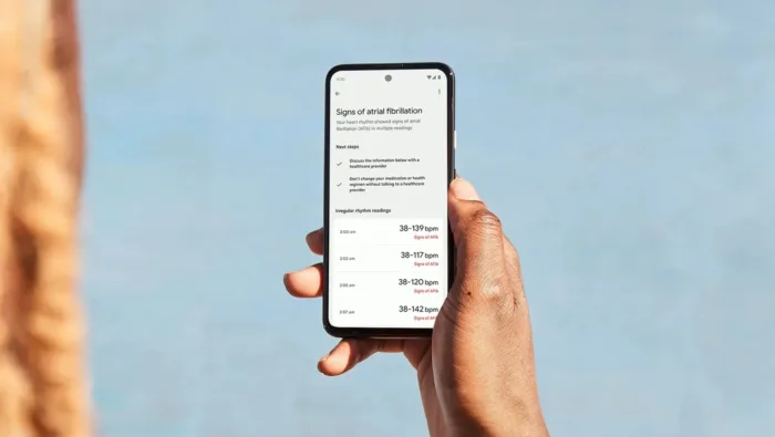 Fitbit facilite le partage des données sur la fibrillation auriculaire avec les médecins