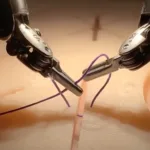 surgical robot
